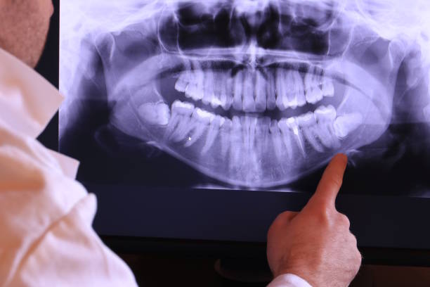 Best Same-Day Emergency Dentist in Anacoco, LA