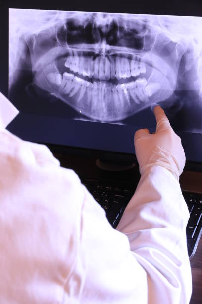 Best Emergency Root Canal Treatment in Anacoco, LA