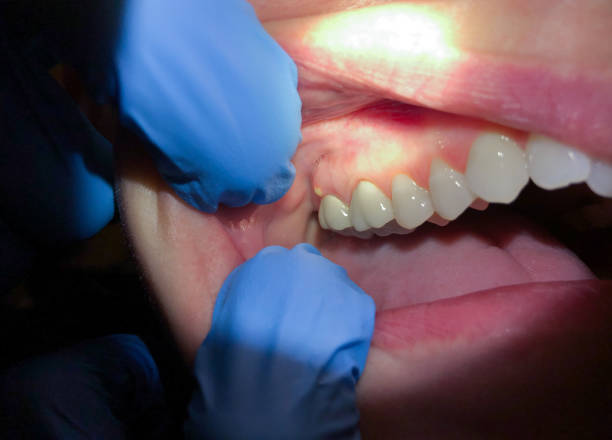 Best Urgent Dental Care in Anacoco, LA