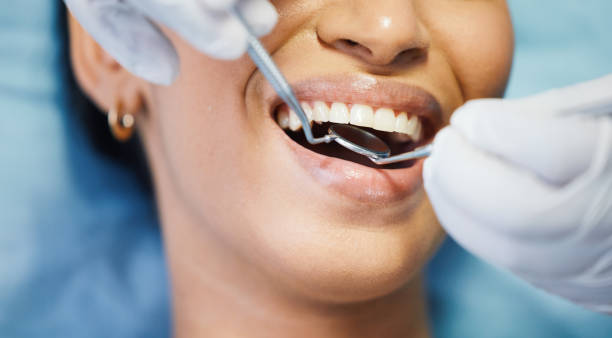 Best Emergency Treatment for Toothache in Anacoco, LA
