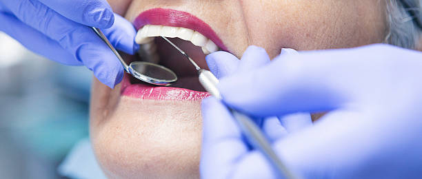 Best Walk-In Emergency Dentist in Anacoco, LA