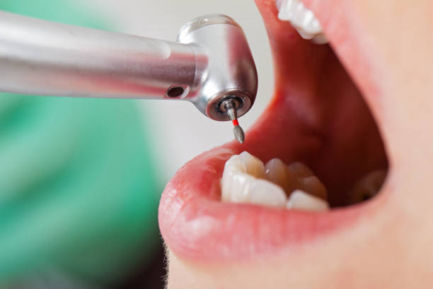 Best Weekend Emergency Dentist in Anacoco, LA